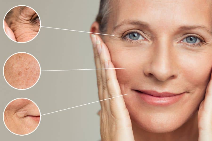 Woman pulling back skin on her face