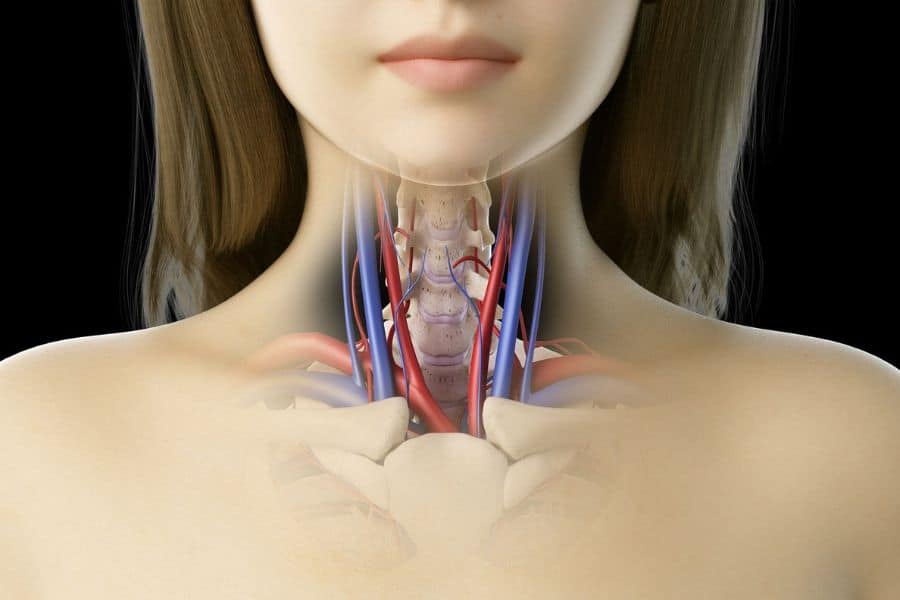 Medical illustration of a woman’s neck and lower face with the throat structures and major blood vessels shown beneath the skin. This visual supports educational content about how blood flow issues may relate to stroke symptoms.