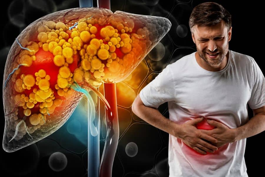 A medical illustration shows a liver filled with yellow fatty deposits beside a man clutching his upper abdomen in pain. A red glow over his stomach suggests discomfort associated with liver disease.