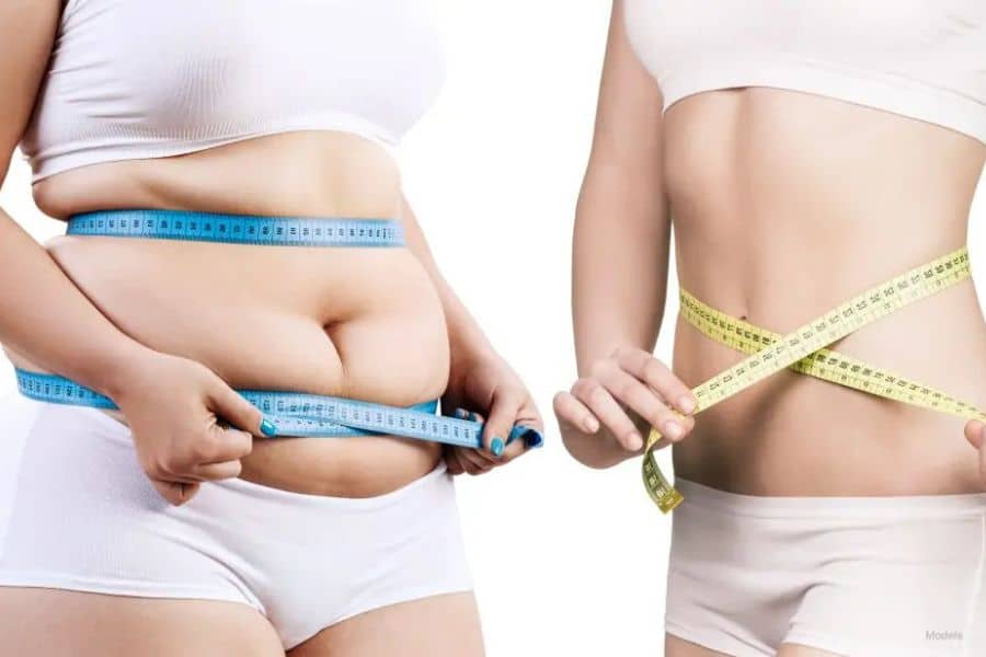 Two women in white activewear measure their waists against a white background. One has a fuller midsection with blue measuring tape while the other has a slimmer waist wrapped in yellow measuring tape. Small text reads "Models".